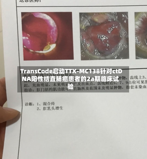 TransCode启动TTX-MC138针对ctDNA阳性结直肠癌患者的2a期临床试验