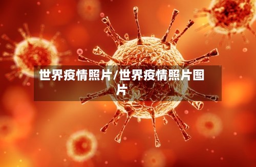 世界疫情照片/世界疫情照片图片